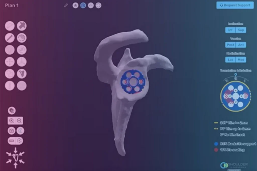 TSA planning image using ProVoyance®