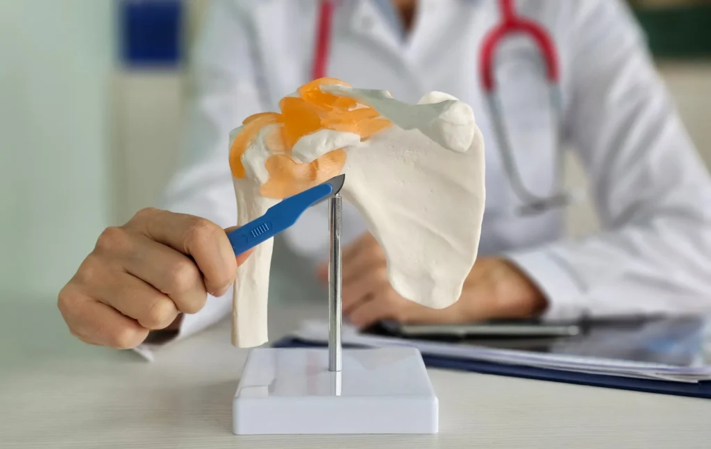 Doctor with an anatomical 3D rendering of the shoulder joint